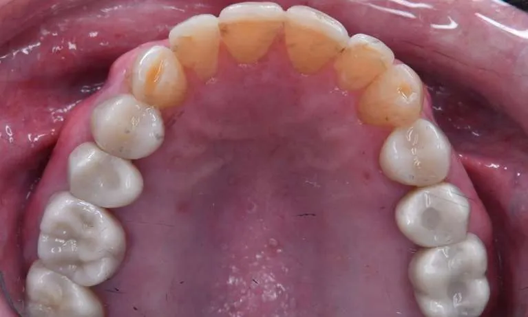 After, second angle of comprehensive transformation