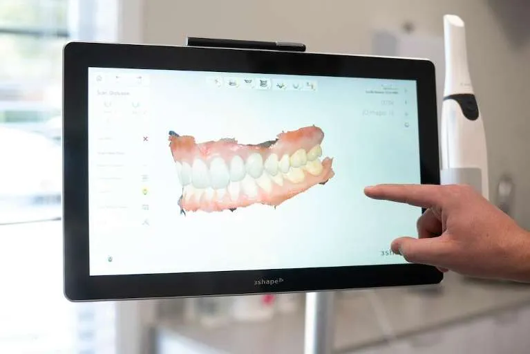 Digital intraoral scanner used for impressions at Vandervoort Family Dentistry